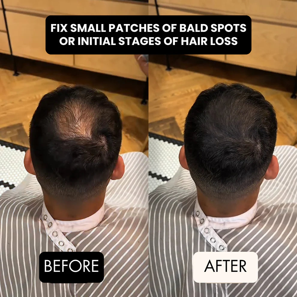 HairFiller - Instant Hair Density in 10 Seconds
