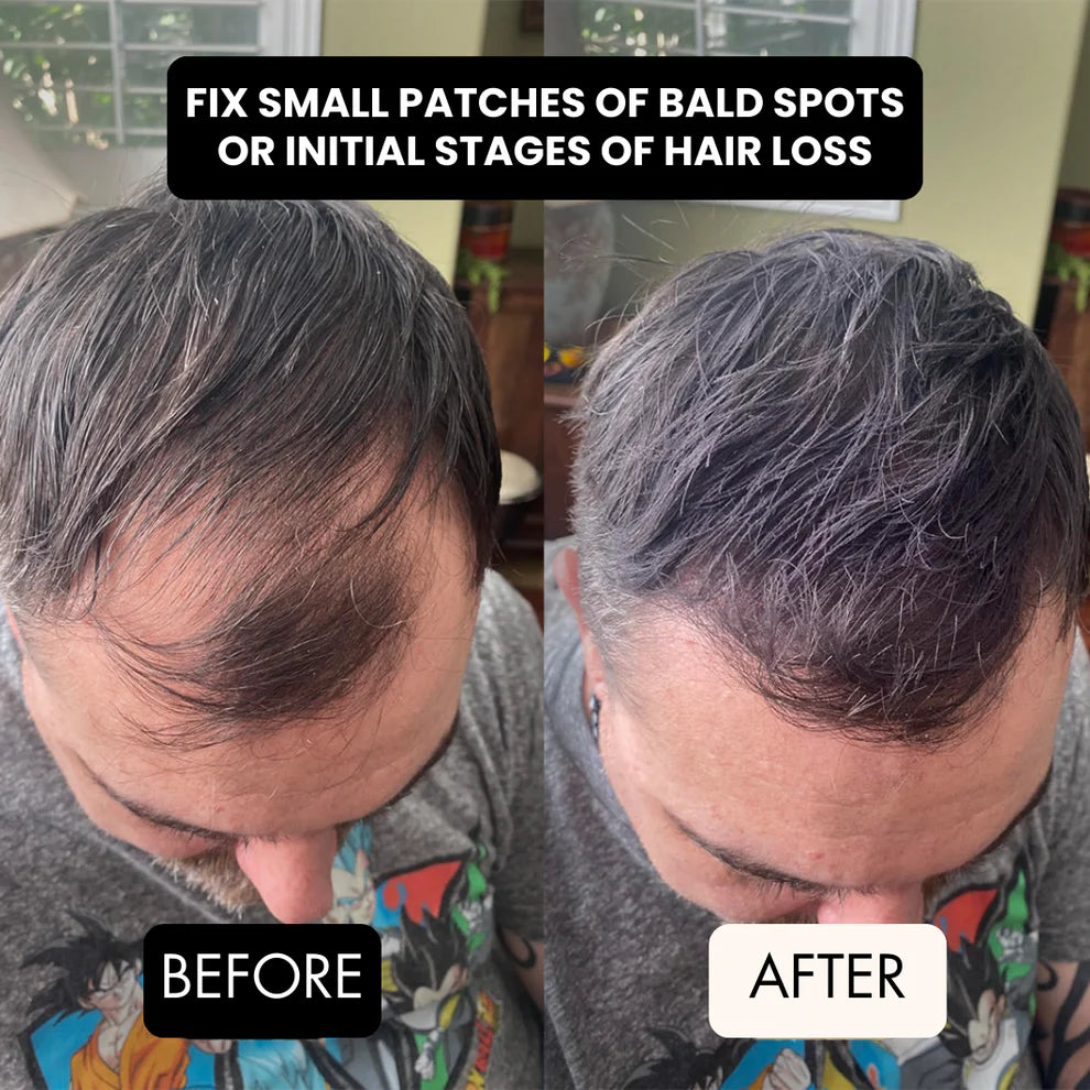 HairFiller - Instant Hair Density in 10 Seconds