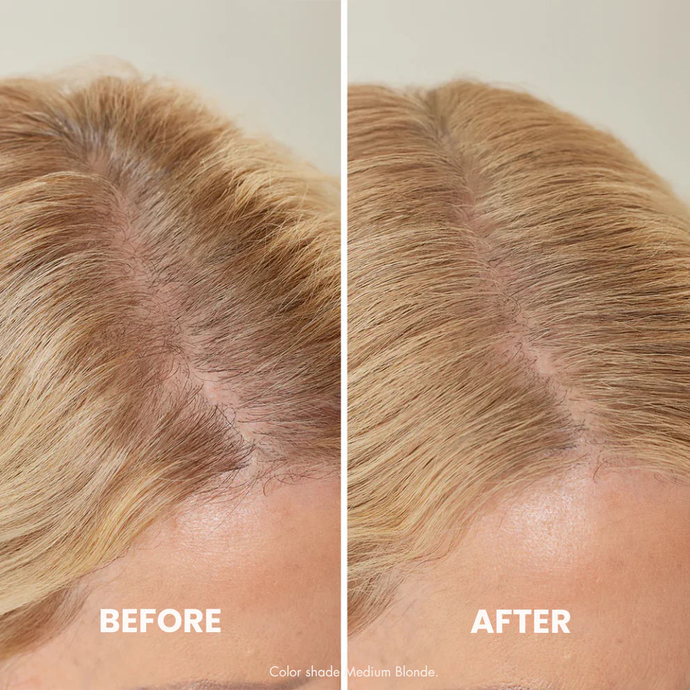 HairFiller - Instant Hair Density in 10 Seconds