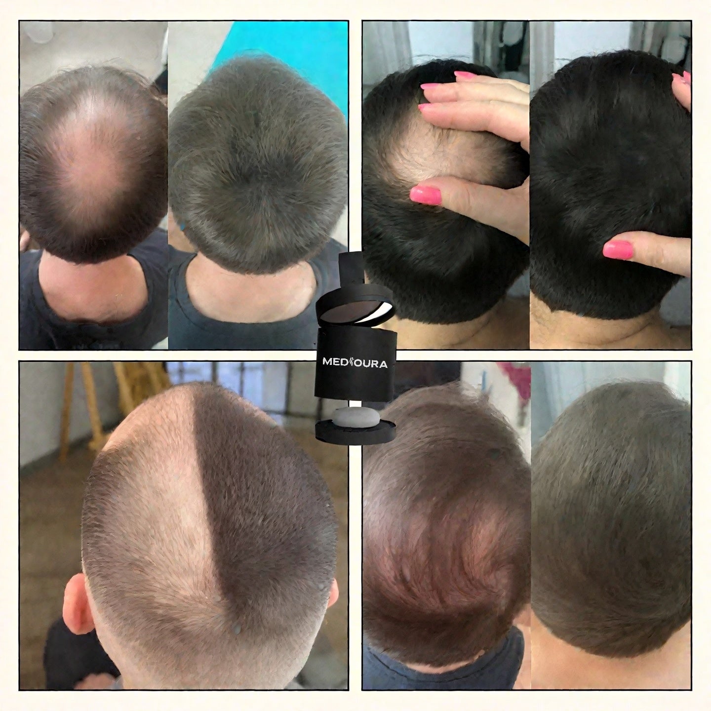HairFiller - Instant Hair Density in 10 Seconds